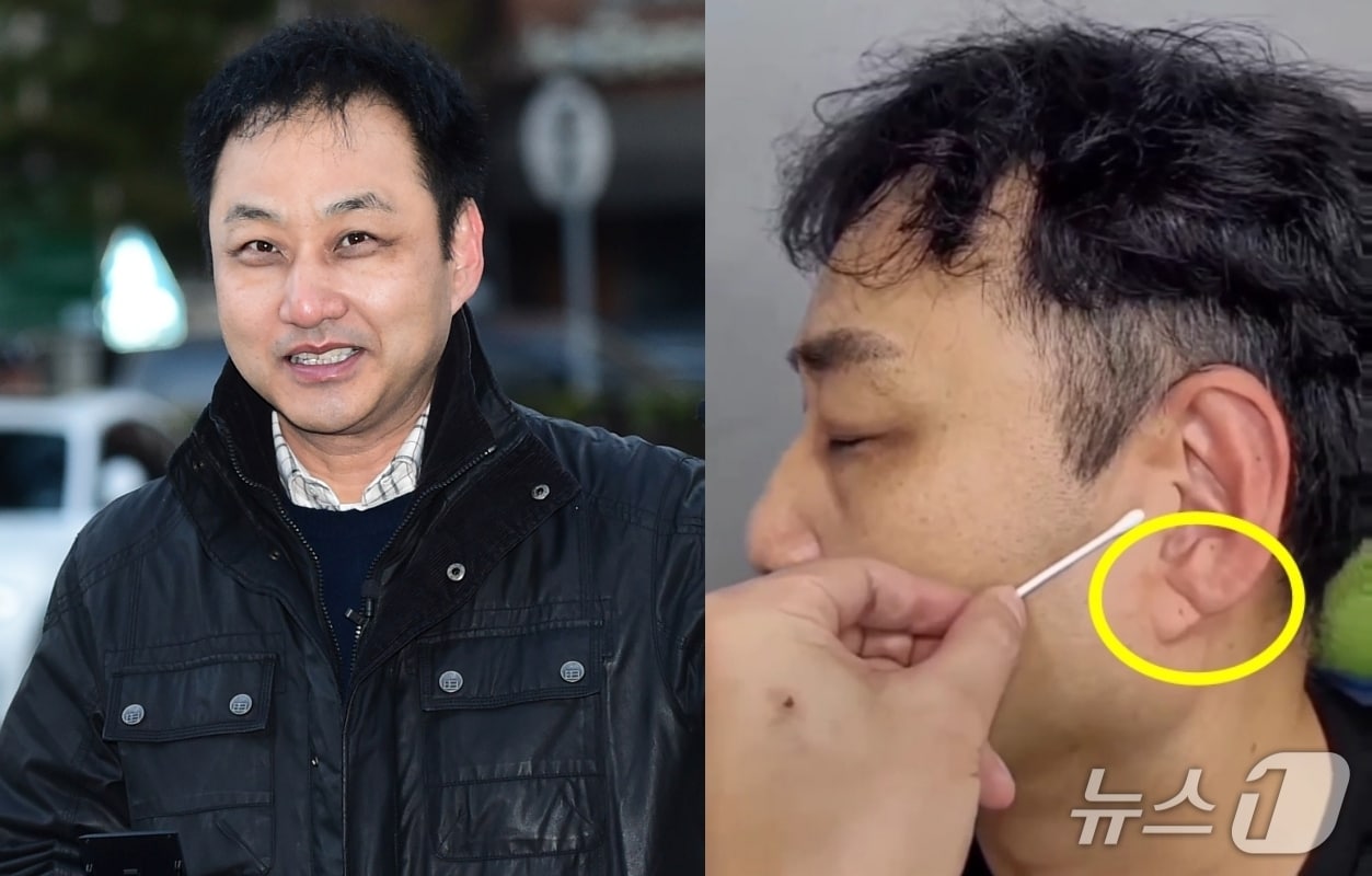 귓불에 대각선 깊은 주름이"…의식 잃은 김수용, 전조 증상이었나 - 뉴스1