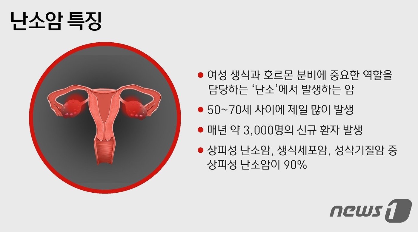 생생 건강정보] "초기증상 전혀 없다"…'침묵의 암' 난소암 매년 3000명 - 뉴스1