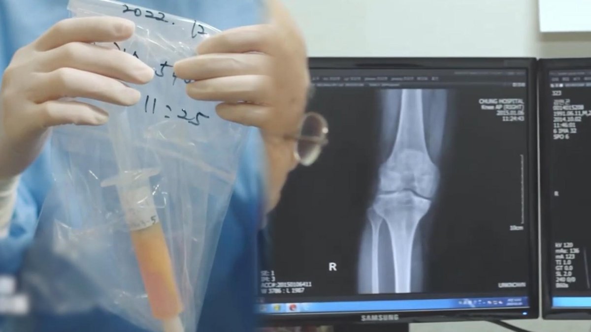 "줄기세포 없이 연골세포 자체가 회복됐다"…기존 치료 패러다임 뒤집은 단백질 억제제 3 줄기세포 치료제 지정 뉴스
